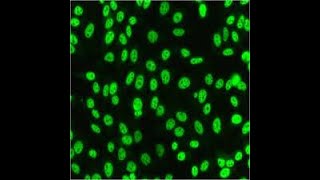 IIFANA STAINING PATTERNS INTERPRETATION  ANTINUCLEAR ANTIBODIES TESTING OF AUTOIMMUNE DISORDERS [upl. by Shulman41]