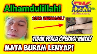 PIJAT REFLEKSI MATA BURAM Alhamdulillah 100 persen berhasil mata kembali jernih hanya 5 menit [upl. by Muna347]