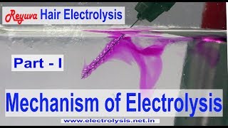 How Hair Electrolysis works [upl. by Samale995]