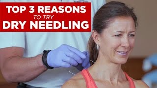 Top 3 Reasons to Try Dry Needling [upl. by Ahsirtak]