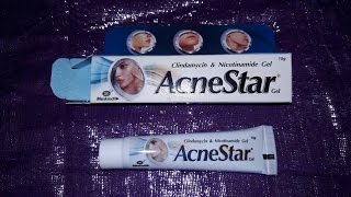 AcneStar Gel Review Hindi [upl. by Ianteen]