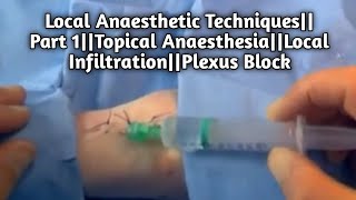 Local Anaesthetic TechniquesPart 1Topical AnaesthesiaLocal InfiltrationPlexus Block [upl. by Katerina]