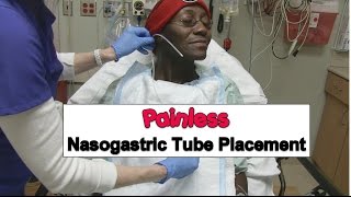 Painless Nasogastric Tube Placement [upl. by Susanne]