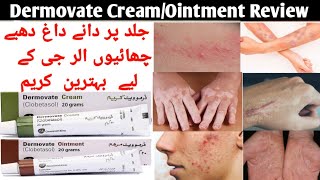 Dermovate Cream Uses Dermovate ointment Uses Clobetasol Cream Uses and Side effects in Urdu Hindi [upl. by Orfield]