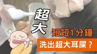 【診所洗耳患者】短短1分鐘竟然清洗出quot魔王級quot耳屎，驚訝到護士措手不及 [upl. by Daye]