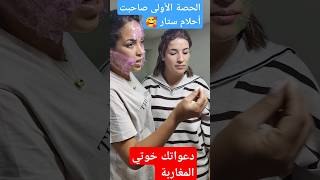 الحصة الأولى عند حنان إزالةالكلف اكسبلور ازالةالتجاعيد تيكتوك ترند tattoo [upl. by Anayd]