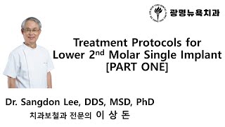 Treatment Protocols for Lower 2nd Molar Single Implant PART 1 [upl. by Annis]