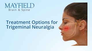 Facial Pain Treatment Treatment Options for Trigeminal Neuralgia [upl. by Ecinuahs]