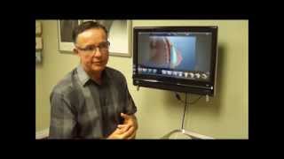 Breast Implant Placement Under or Over The Muscle [upl. by Gabbie]