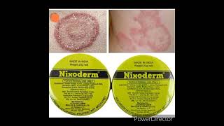 Nixoderm cream for skin problem Made in India Nixoderm cream [upl. by Esinyl]