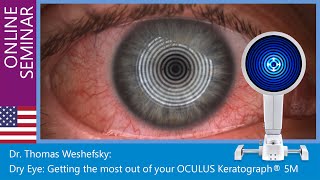 Dr Thomas Weshefsky Dry Eye Treatment with the OCULUS Keratograph® 5M topographer [upl. by Spike]