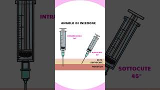 INIEZIONE SOTTOCUTANEA [upl. by Norat]