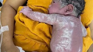 Baby feeding amp care time❤️🙏Vlogarifinniloyentertainment cutebaby newbornbaby nicu babyfeed [upl. by Giverin]