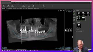 Dental Treatment Planning in a Medically Compromised Case [upl. by Babs776]