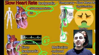 Slow Heart Rate Causes Bradycardia Causes Bradycardia symptoms signs and treatment [upl. by Mccafferty]