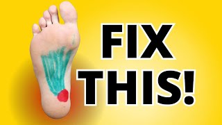 Plantar Fasciitis A New Treatment for an Old Problem of Foot Pain [upl. by Vogel]