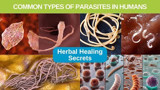 Common Parasites In Humans And Where They Come From [upl. by Akierdna]