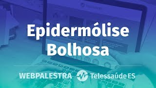 WebPalestra Epidermólise Bolhosa [upl. by Anailuy]