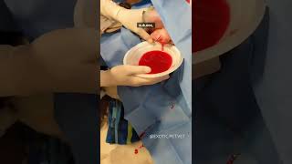 How to surgically fix a canine ear hematoma by a veterinarian [upl. by Free794]