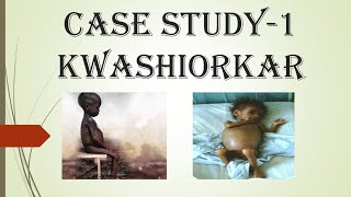 CASE STUDY 1KWASHIORKORPROTEIN ENERGY MALNUTRITION [upl. by Ettezus]