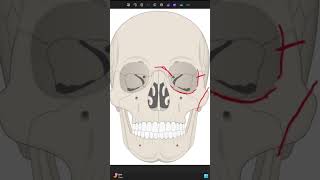 Le Fort Fracture meded omfs trauma criticalcare emergencymedicine [upl. by Boelter241]