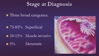 Bladder Cancer [upl. by Ainocal]