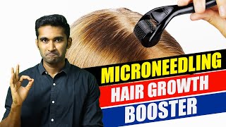 How to do MICRONEEDLING at home for HAIR GROWTHதமிழ் tamil haircare hairgrowth hairloss [upl. by Quitt]