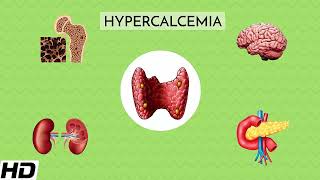 Hypercalcaemia Everything You Need to Know [upl. by Nomelihp]