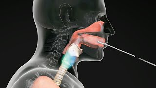 How do Straw Exercises Help the Voice Get Better voicetherapy [upl. by Philana]