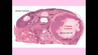 Ovarian Cysts  CRASH Medical Review Series [upl. by Ulrica]