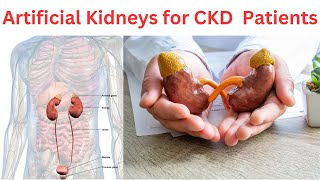 Artificial Kidneys A Promising Future for Chronic Kidney Disease Patients [upl. by Amian579]