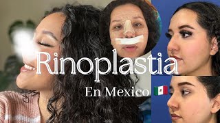 Me hice la rinoplastia en Mexico y grabé todo Mi experiencia con la rinoplastia  Me arrepiento [upl. by Vincents566]