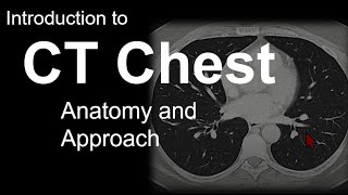 Introduction to CT Chest  Anatomy and Approach [upl. by Anisamoht740]