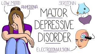 Depression Explained Major Depressive Disorder [upl. by Wesla890]