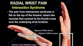 Wrist Paincauses and treatmentPart 2  Everything You Need To Know  Dr Nabil Ebraheim [upl. by Atteiram156]