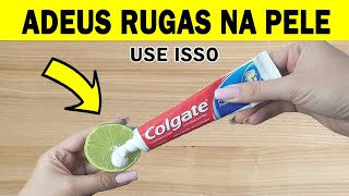 ISSO TIRA RUGAS E PELE VELHA SUPER RÁPIDO – LIMÃO e PASTA DE DENTE [upl. by Slohcin]