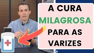 A CURA MILAGROSA PARA AS VARIZES [upl. by Bridie]