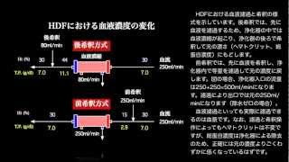 前希釈と後希釈HDFの濾過･希釈様式の違い [upl. by Jennica]