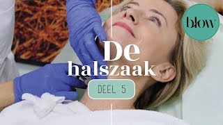 De halszaak 5  BLOW  74 [upl. by Anauq]