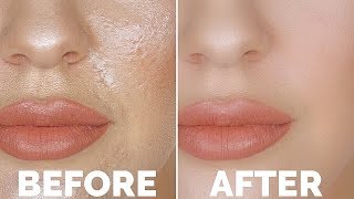 How To STOP Oily Skin  The Number 1 Oily Skin Trick You NEED TO KNOW [upl. by Anire]