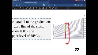 Hematocrit value  Practical hematology  Dr Saiko [upl. by Art672]