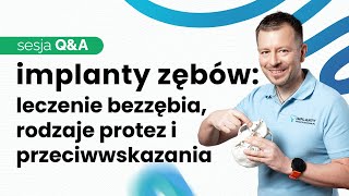 IMPLANTY ZĘBOWE  QampA cz II📣PROTEZY NA 4 I 6 IMPLANTACH PRZECIWWSKAZANIA DO LECZENIA [upl. by Athalie]