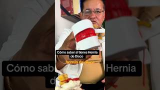 ¿Hernia de disco Detecta los síntomas y evita complicaciones herniadedisco salud youtubeshorts [upl. by Naval]