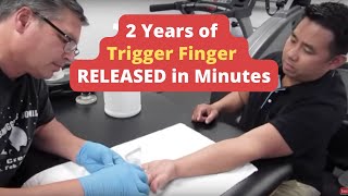 2 Years of  Trigger Finger  RELEASED in Minutes REAL RESULTS [upl. by Prasad963]