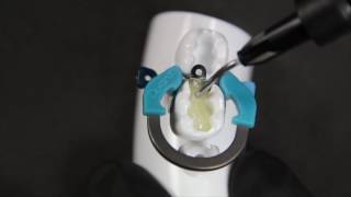 Easy obtention of a tight contact point using Palodent V3  SDR By Dr Andre Reis [upl. by Astrid]