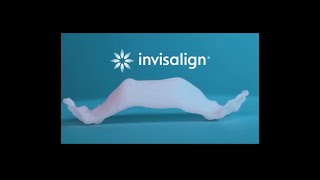 Invisalign Palatal Expander [upl. by Eneleuqcaj196]