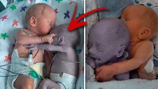 Mom puts the baby to the dying Twin and five minutes later a real Miracle happens  PLOT [upl. by Rentsch]