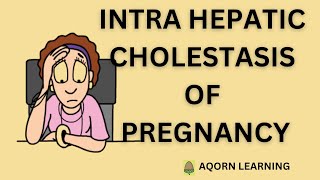 Intrahepatic Cholestasis of PregnancyICP  aqorn learning  rahat2021 [upl. by Ainatnas]