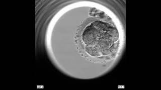 Blastocyst seen with EmbryoScope [upl. by Dlanigger]