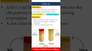 Indole test  Microbiology  by ImranYaseen [upl. by Sharpe]